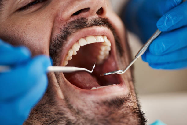 Best Mobile Emergency Dentist in South Barre, VT
